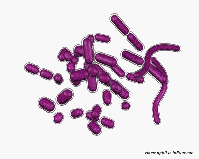 H.influenzae morphology in CSF